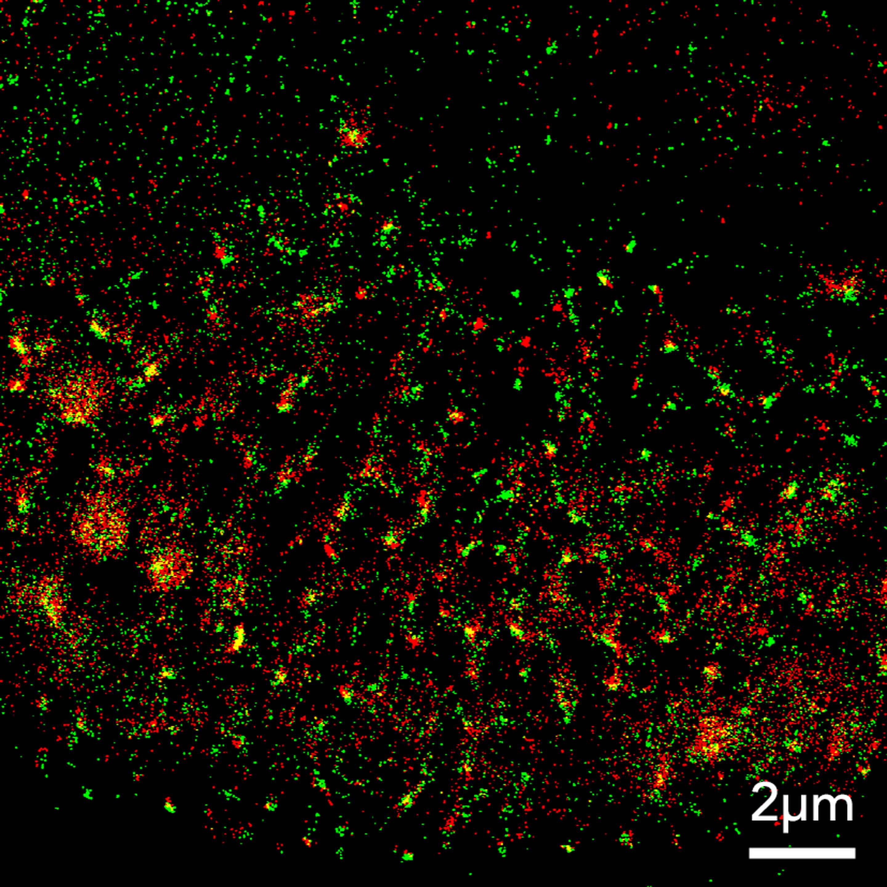 Protein Components Of Virus Particles In Sars Cov Infected Cells