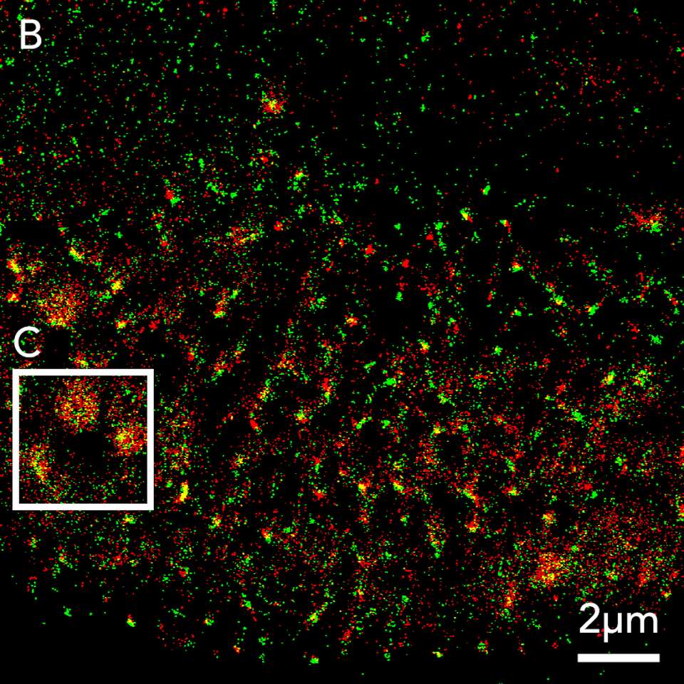 Protein Components Of Virus Particles In Sars Cov Infected Cells