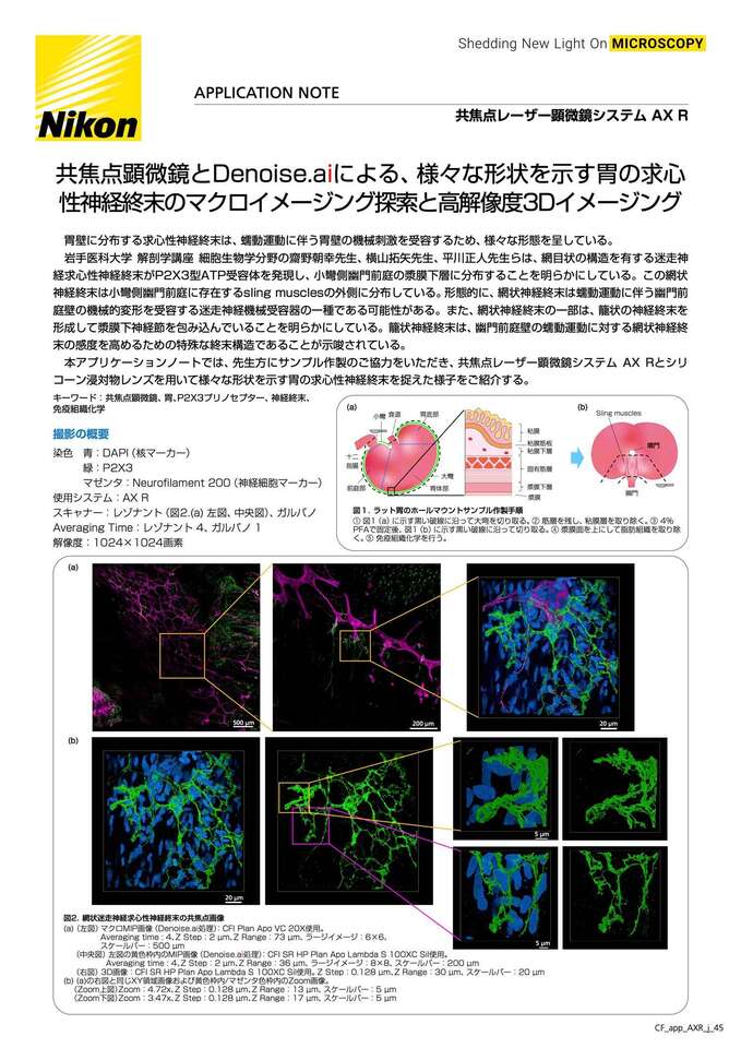 生体共焦点顕微鏡検査 角結膜がみえてくる/メジカルビュ-社/近間泰一郎（単行本） 生体共焦点顕微鏡検査 角結膜がみえてくる/メジカルビュ-社/近間