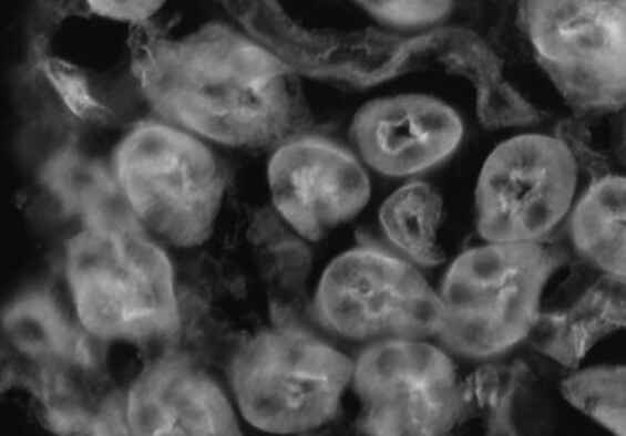 Konventionelle Kamera