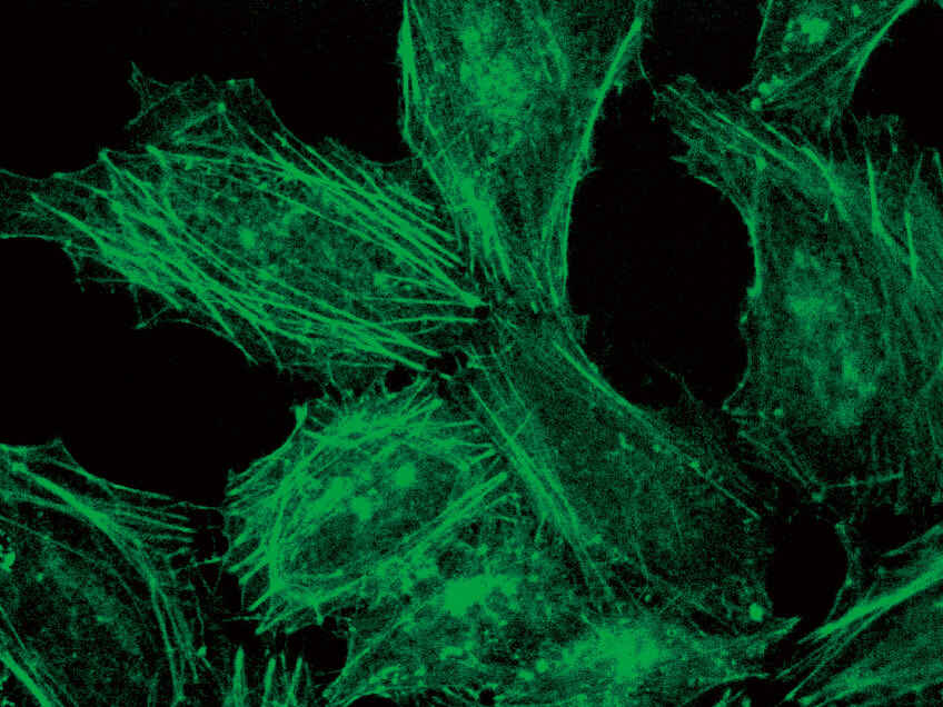 Durchlicht-Fluoreszenz Beispiel