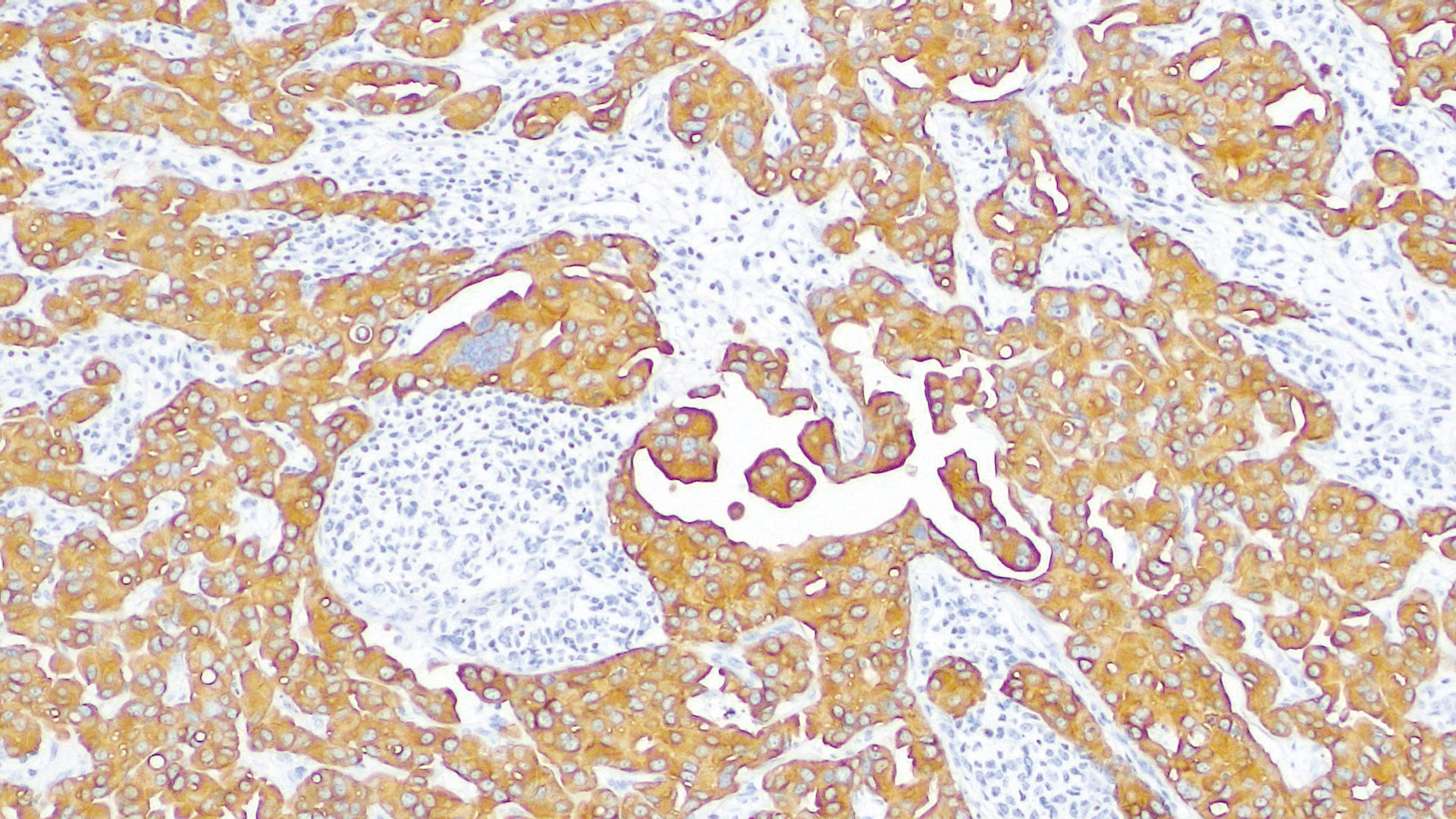 LED mit konstanter Farbtemperatur – Beispielaufnahme 10X