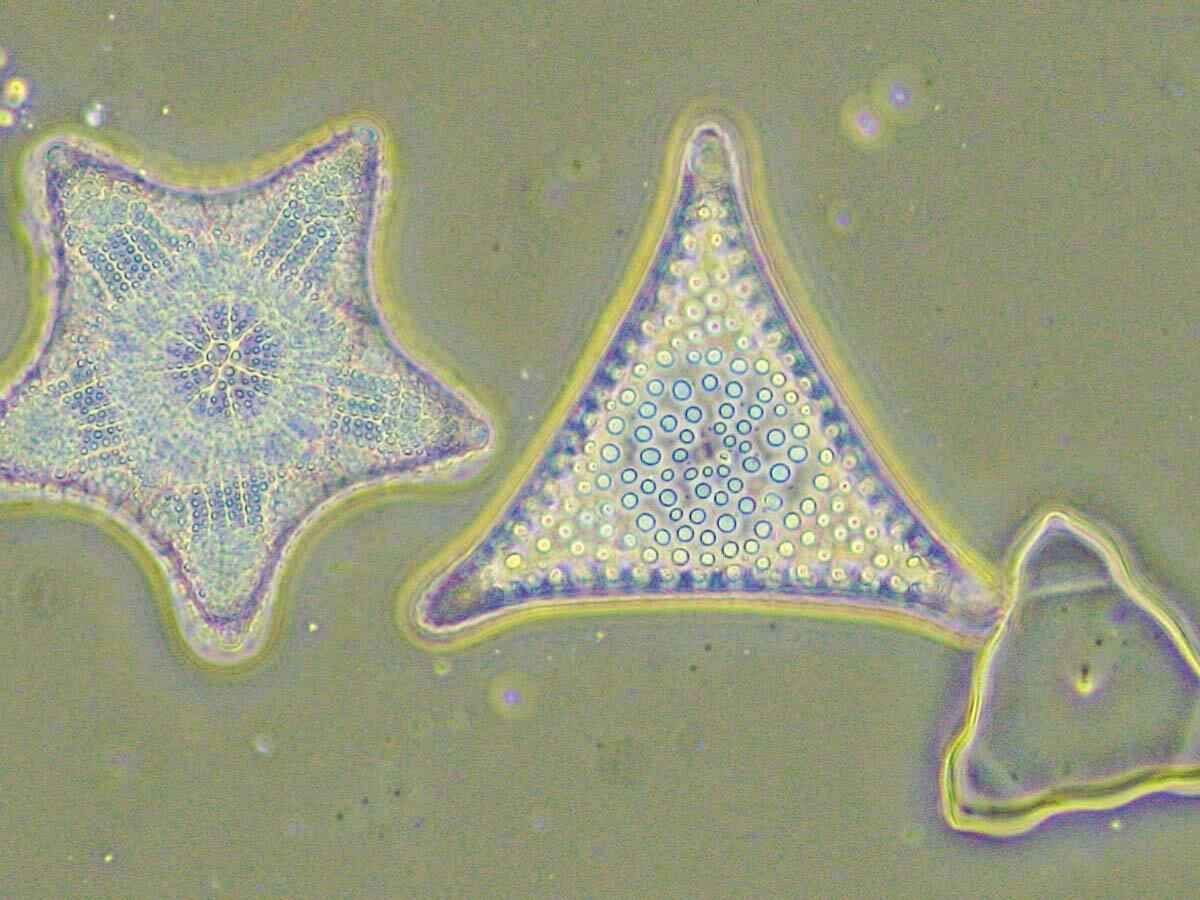 Phasenkontrast Beispiel