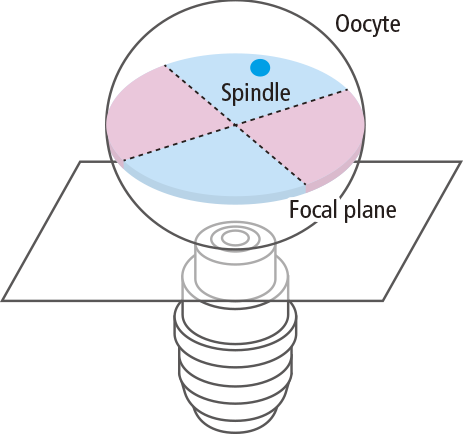 Spindel Schema