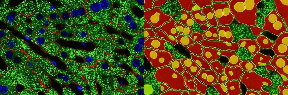 Custom Image Processing and Analysis | Applications | Nikon BioImaging ...