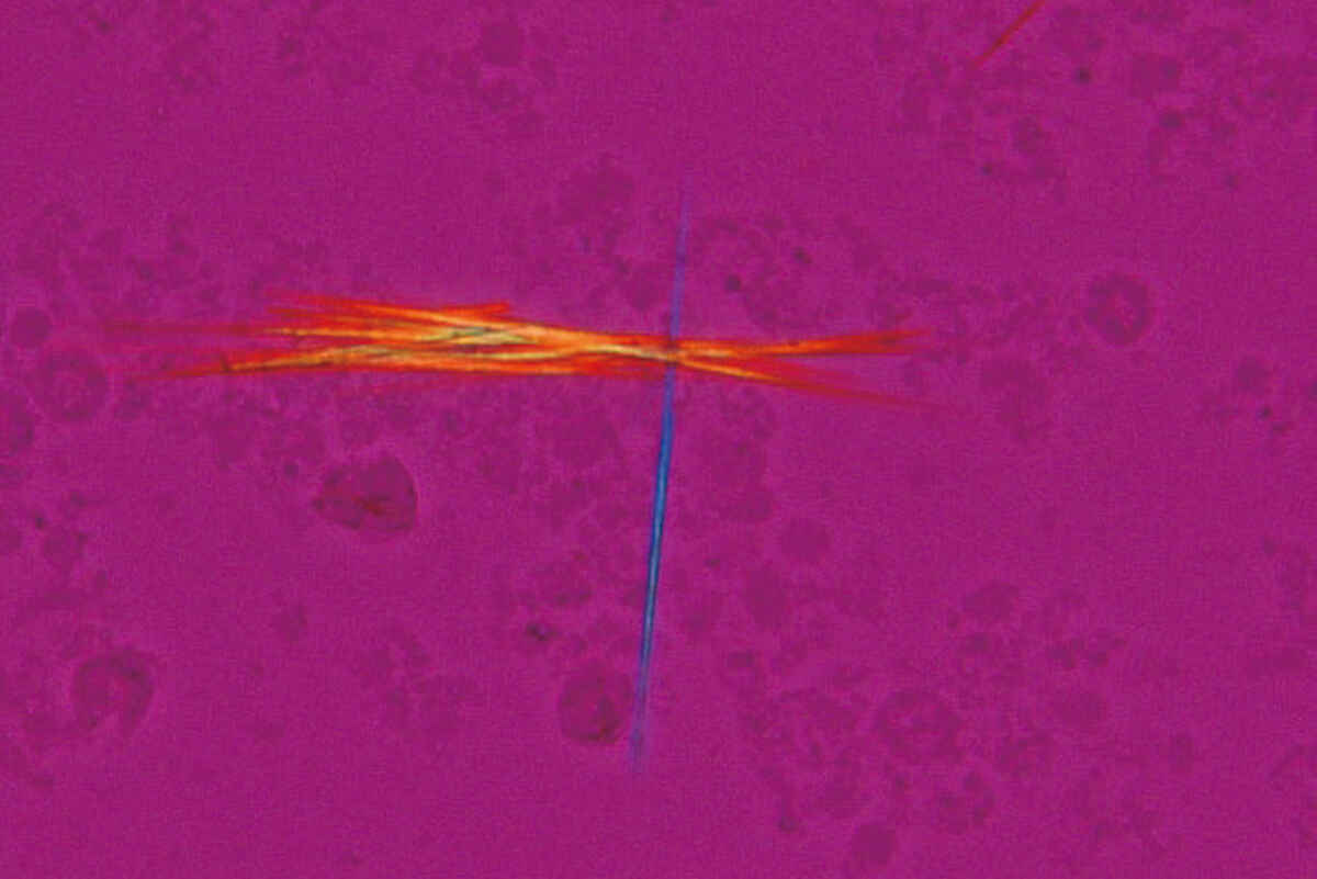 Use Of Polarizing Microscope