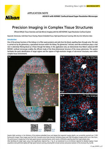 Microscope Systems for Life Science Research & Healthcare | Nikon ...