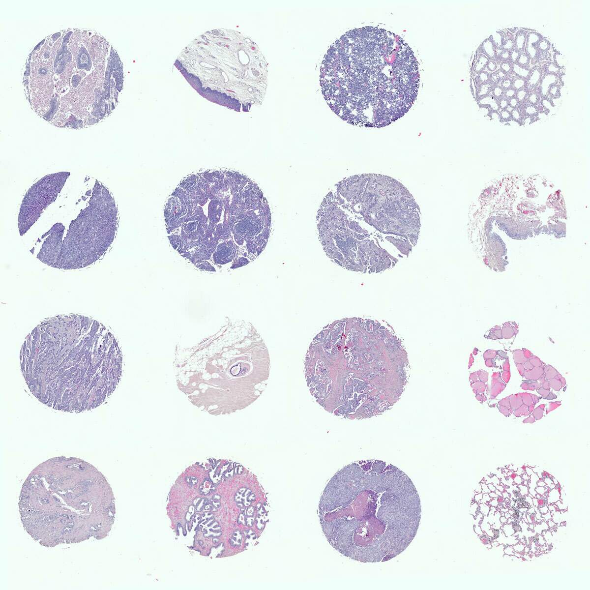 Tissue Microarray of various human tissues stained with H&E | Galleries ...