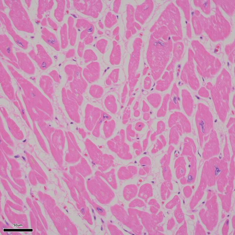 Myocardium - HE Staining (40X) | Galleries | Nikon Instruments Inc.