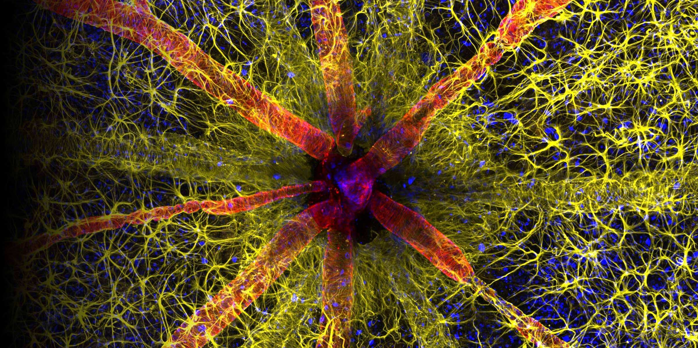 Microscope Systems for Life Science Research & Healthcare | Nikon ...