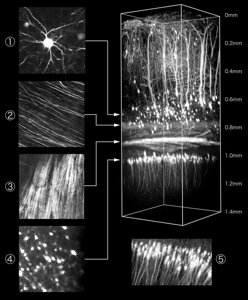 Focus On Neurobiological Imaging | Resources | Nikon Instruments Inc.