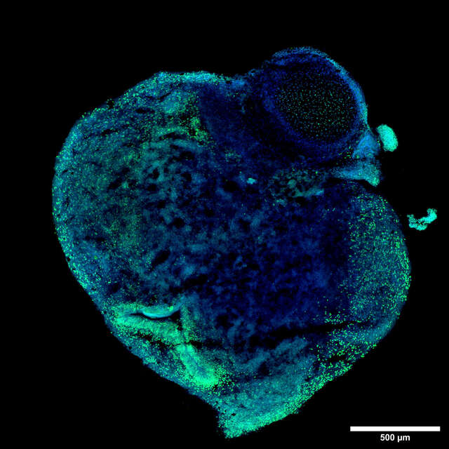 Crest X-Light V3 | CrestOptics X-Light Series | Confocal and