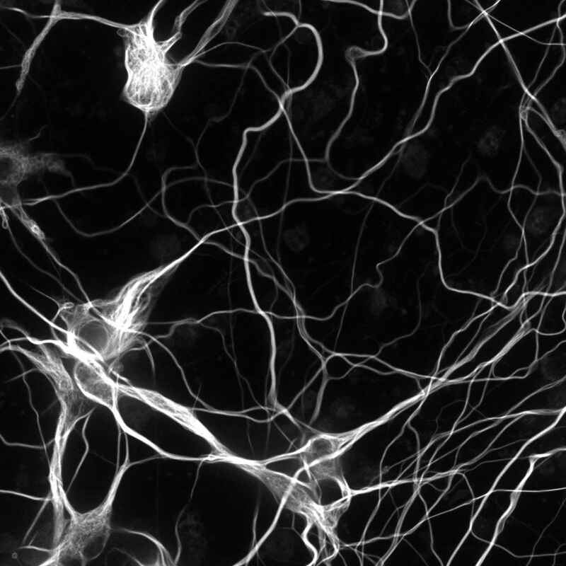 Crest XLight V2 CrestOptics XLight Series Confocal and Multiphoton Microscopes