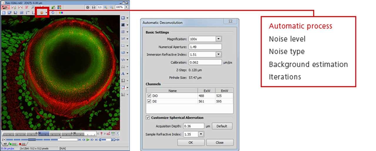 NIS-Elements Confocal &amp; Enhanced Resolution | NIS-Elements 