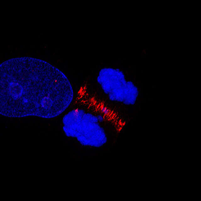 NIS-Elements Confocal | NIS-Elements | Software | Nikon Microscope