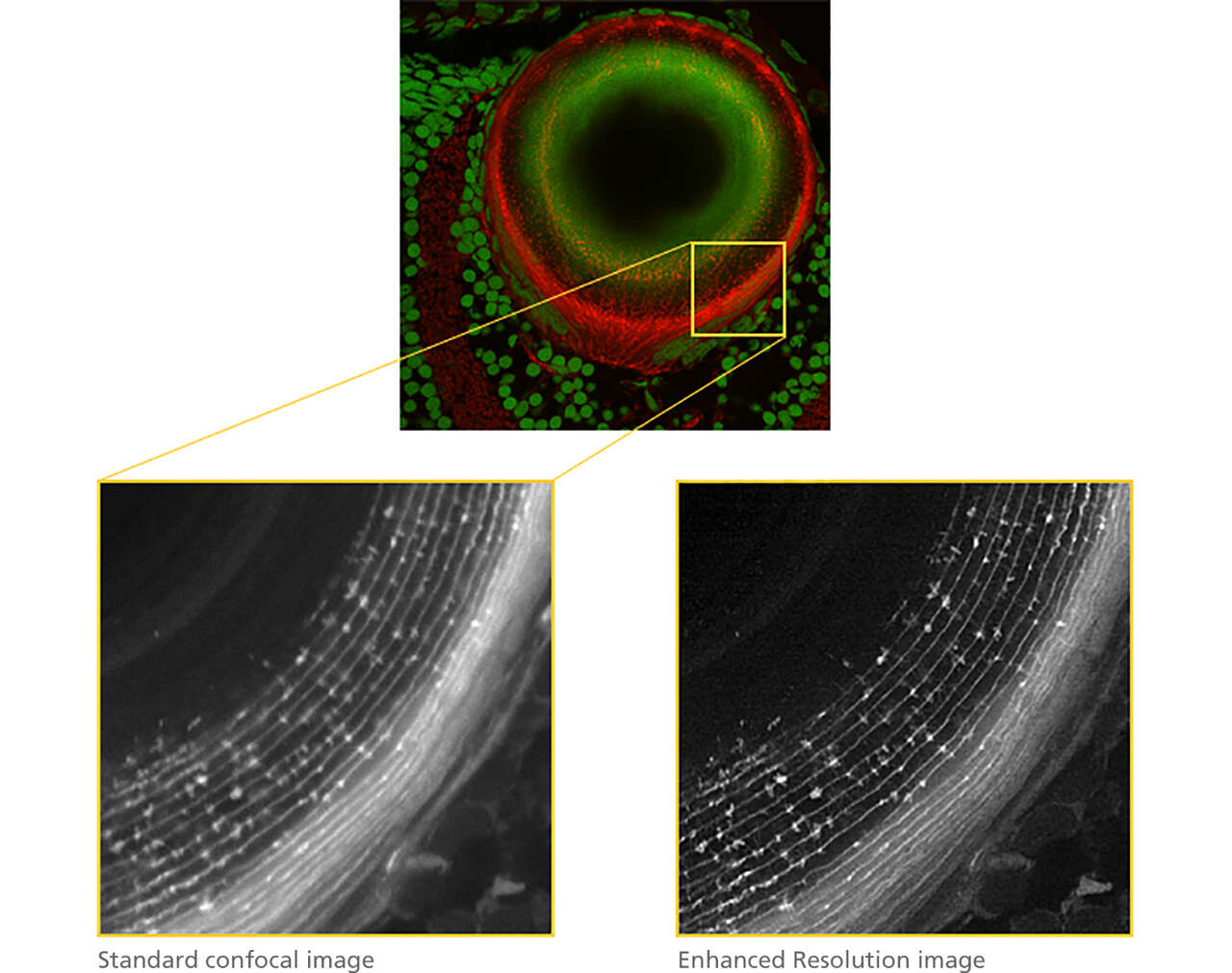 NIS-Elements Confocal | NIS-Elements | Software | Microscope