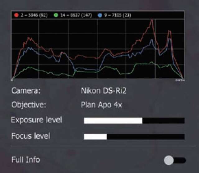 NIS-Elements L | Cameras | Microscope Products | Nikon NIS-Elements L | Cameras | Microscope Products | Nikon