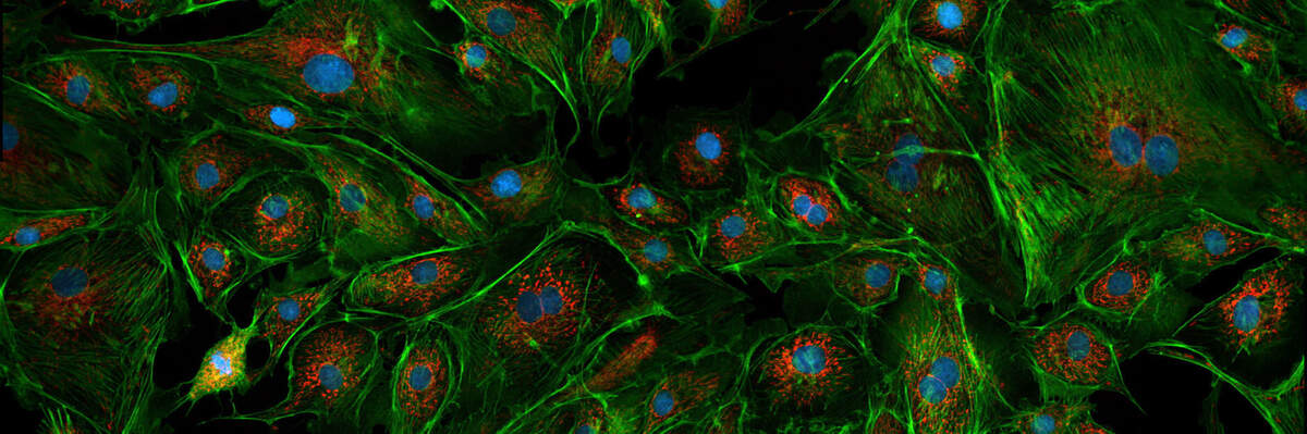 Intensilight Epi-fluorescence Illuminator | Light Sources | Microscope ...