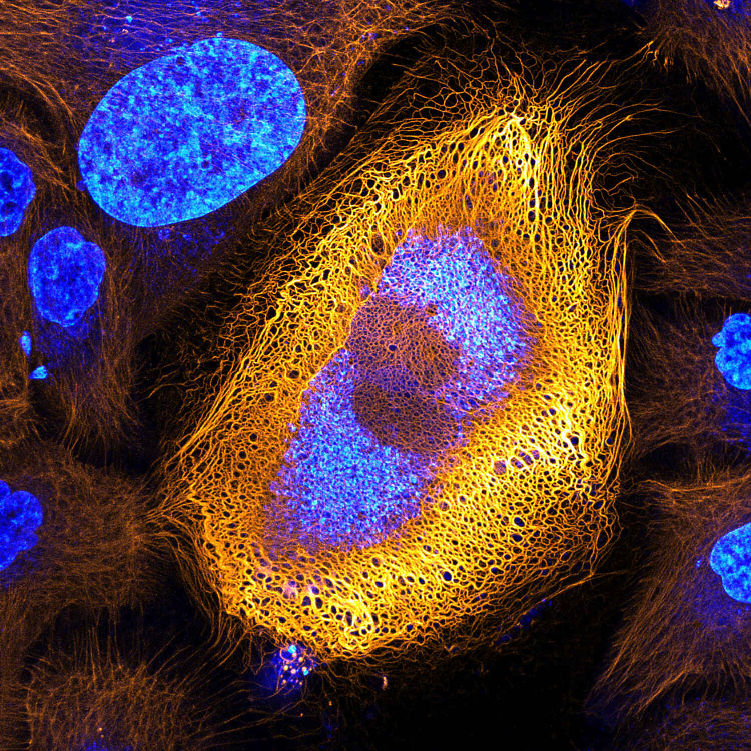 Uitscheiden Kinderpaleis knijpen Stunning Microscopic View of Human Skin Cells Wins 2017 Nikon Small World  Competition | News | Nikon Instruments Inc.