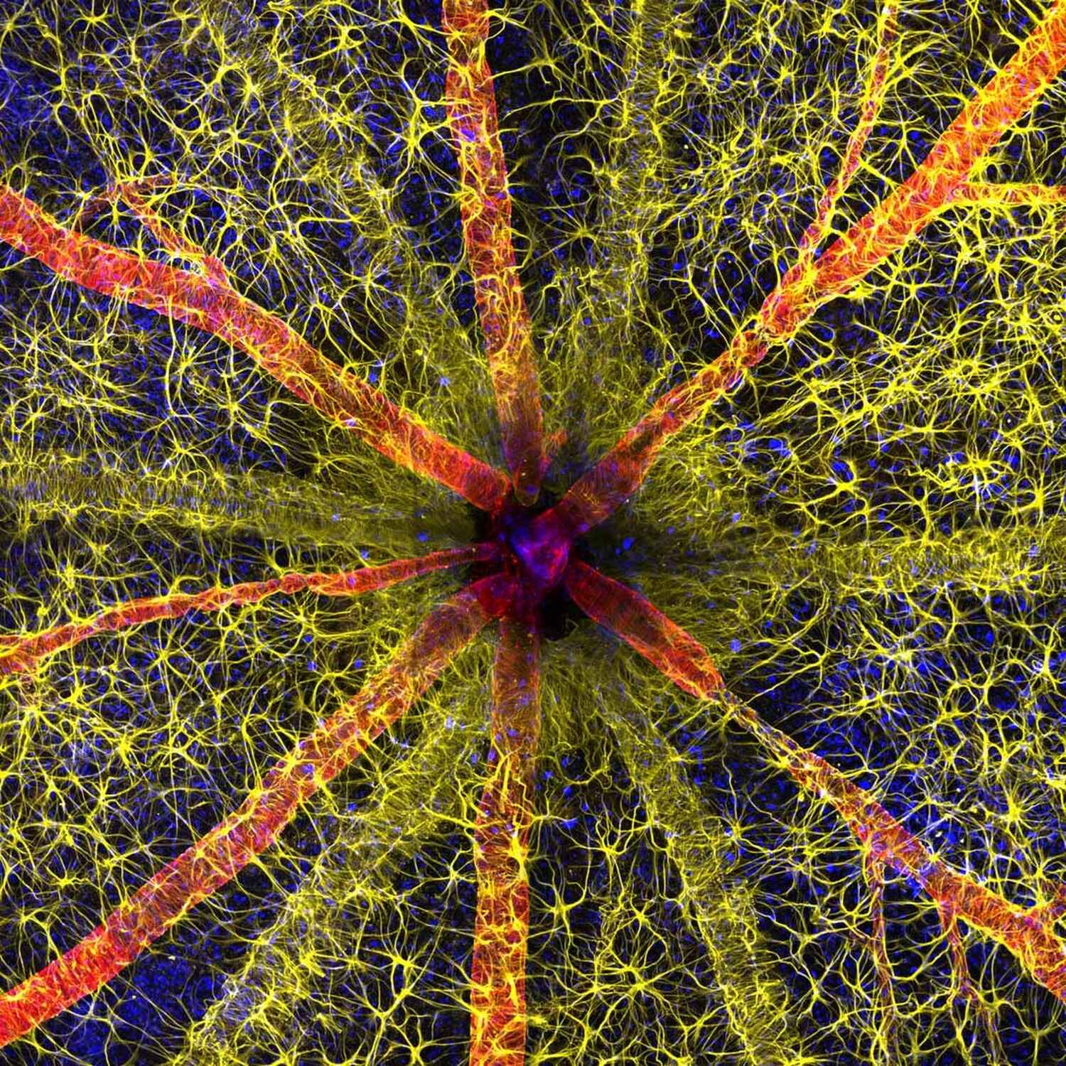 Rodent Optic Nerve Head Wins the 49th Annual Nikon Small World Photo  Microscopy Competition, News