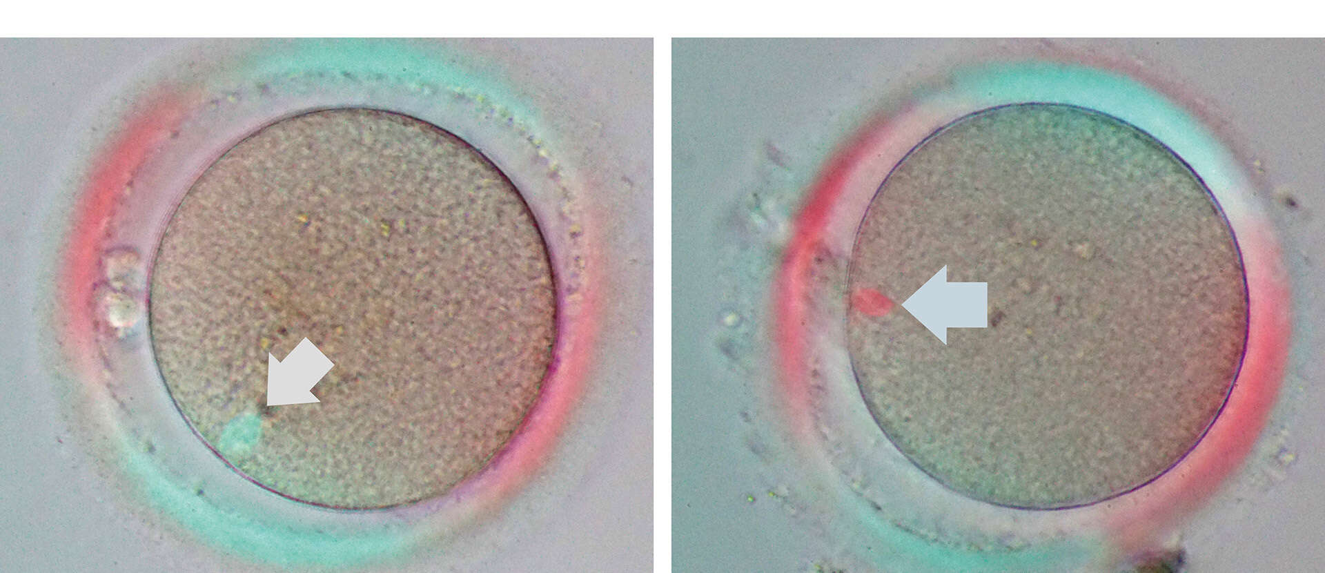 ECLIPSE Ti2-I motorized inverted microscope for reproductive medicine that  streamlines ICSI/IMSI workflow in infertility treatment | Nouvelles | Nikon  Europe B.V.