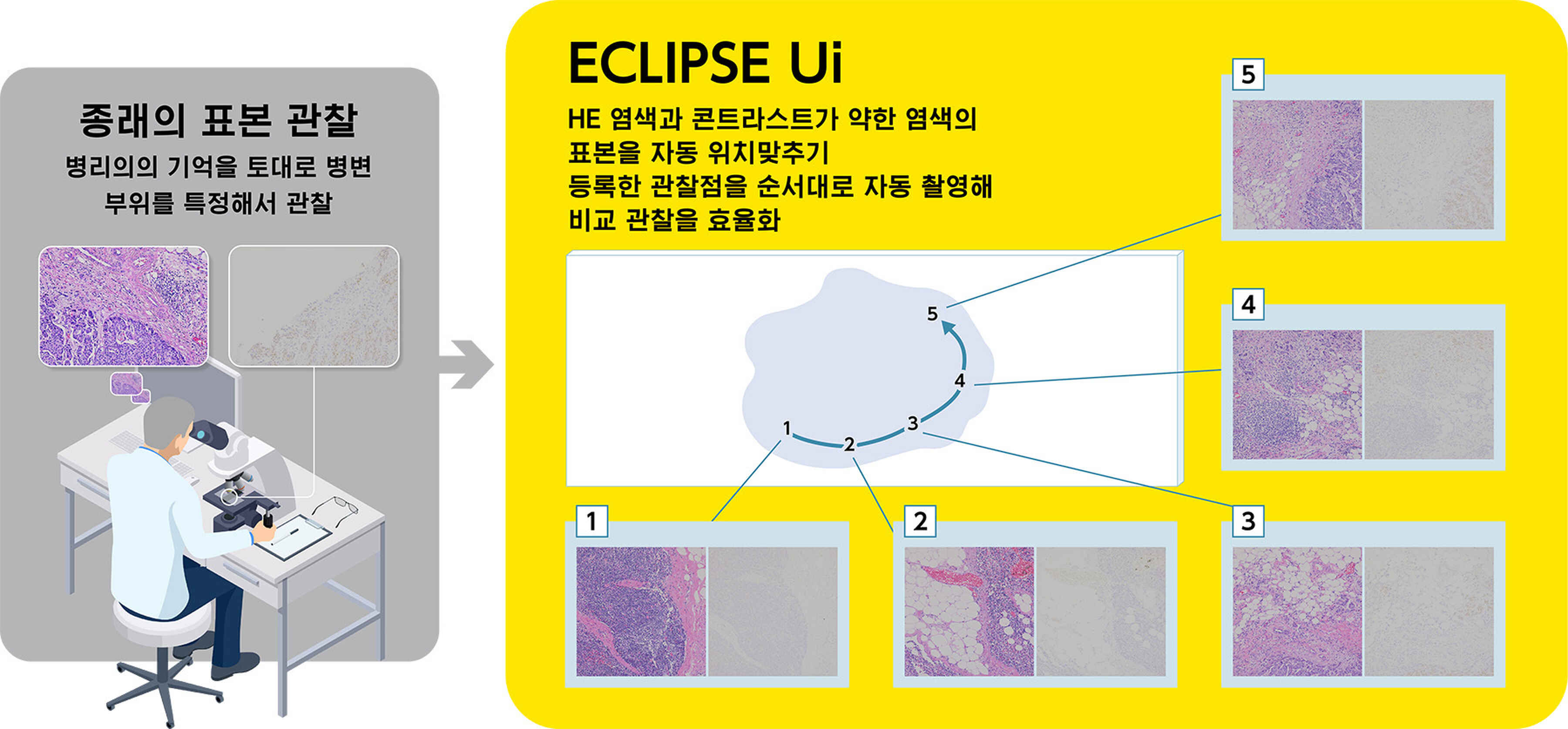니콘, 의료용 디지털 이미징 현미경 ‘ECLIPSE Ui Ver 1.3’을 릴리스 | 뉴스 | 니콘인스트루먼트코리아