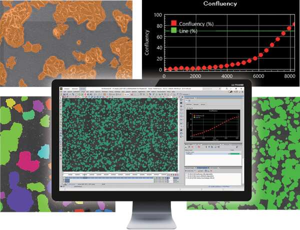 patient Napier Centimeter Image Analysis Software | Cell Screening | Nikon Microscope Products |  Nikon Instruments Inc.