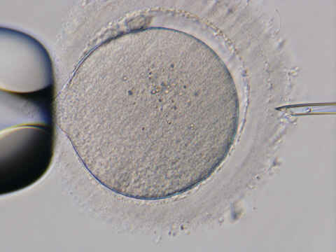 Assisted Reproductive Technology (art) 