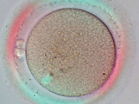 Spindle Microscope Assisted Reproductive Technology (ART) | Klinische Forschung ...