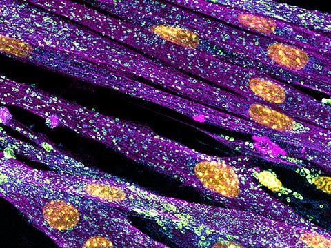 Mioblastos de camundongo cultivados microfotografia fotografia com microscópio