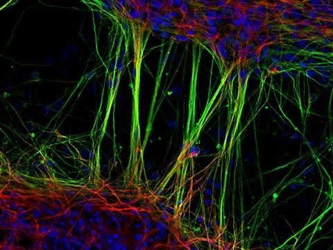 Neurônios humanos derivados de células-tronco neurais microfotografia fotografia com microscópio